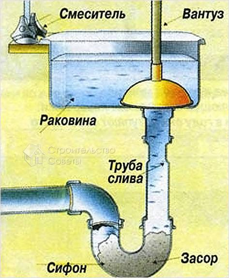Использование вантуза